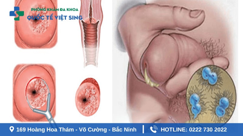 Ảnh hưởng của bệnh lậu đến sức khỏe