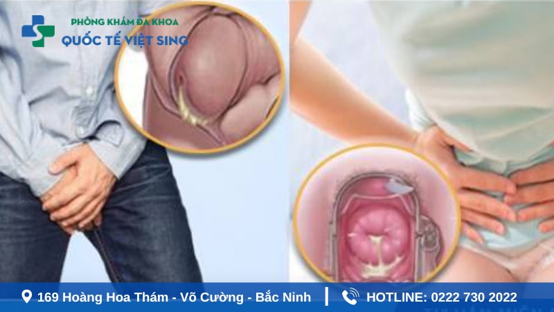 Ảnh hưởng sức khoẻ khi không điều trị bệnh lậu
