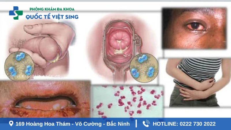 Bị bệnh lậu có nguy hiểm không?