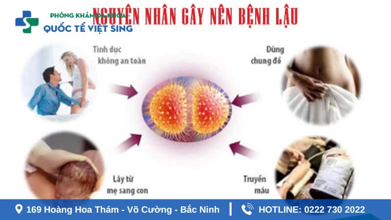 Bệnh lậu giai đoạn đầu là gì? Nguyên nhân lây bệnh