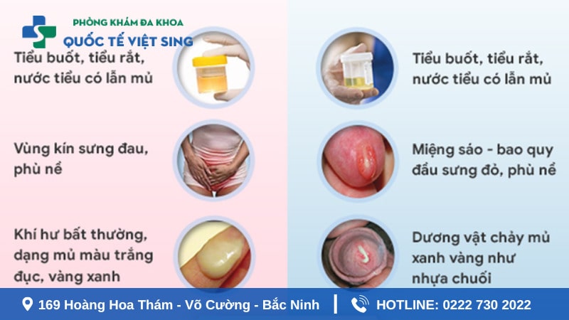 Triệu chứng của bệnh lậu qua từng giai đoạn