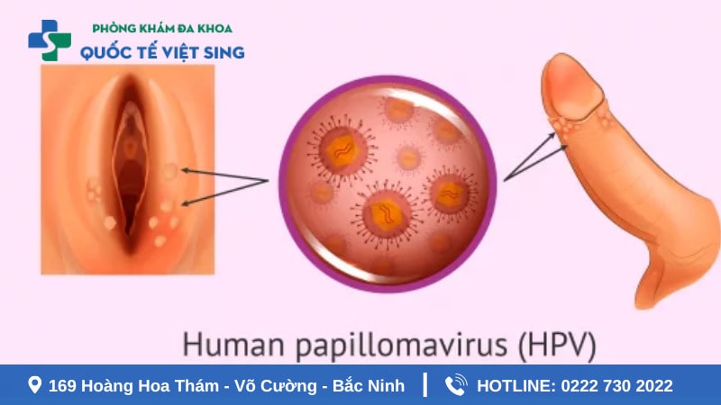 Đôi nét về bệnh lậu là gì? Lây lan qua đâu