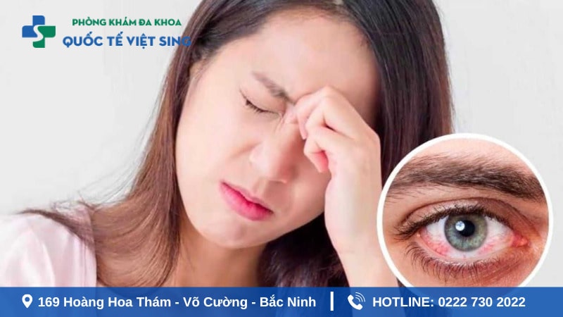 Bệnh lậu ở mắt là gì ?