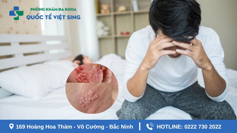 Bệnh lậu ủ bệnh và phát bệnh theo 3 giai đoạn cụ thể