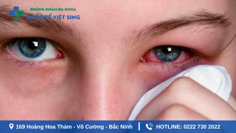 Bị lậu ở mắt có nguy hiểm không?
