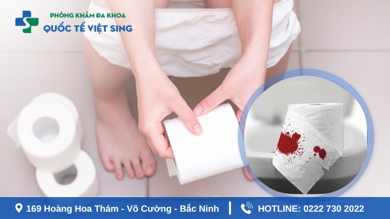Bị đi ngoài ra máu có đáng lo ngại không?