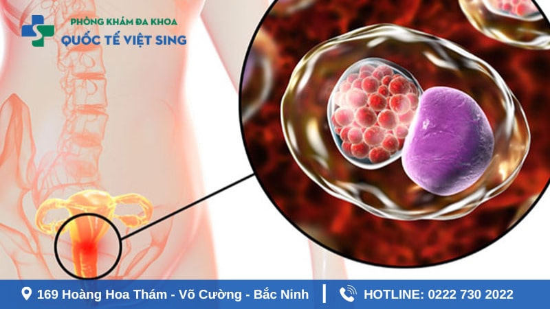 Biến chứng bệnh lậu ở nữ giới