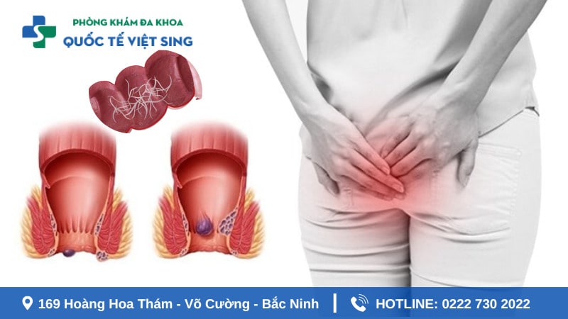 Nguyên nhân quen thuộc khác gây ra ngứa hậu môn