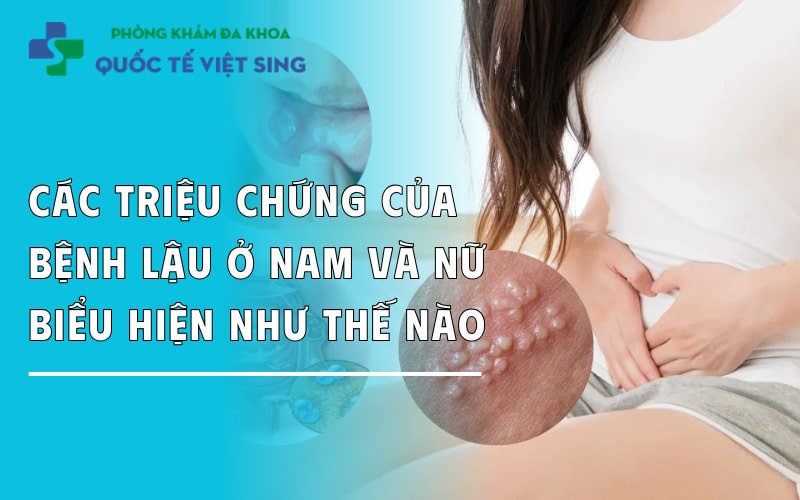 https://dakhoaquoctebacninh.com/wp-content/uploads/2025/06/cac-trieu-chung-cua-benh-lau-o-nam-va-nu.jpg