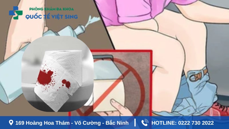 Cần làm gì khi cắt trĩ xong đi ngoài ra máu?
