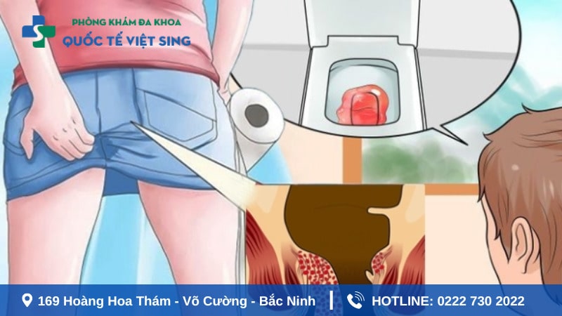 Cắt trĩ xong đi ngoài ra máu có nguy hiểm không ?