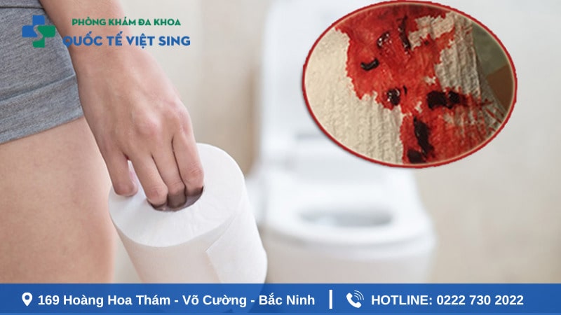 Đại tiện ra máu tươi là hiện tượng gì?