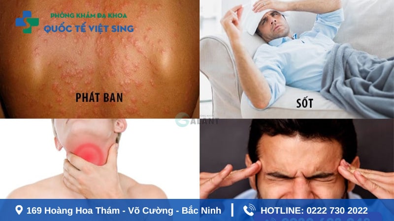 Triệu chứng của HIV qua từng giai đoạn
