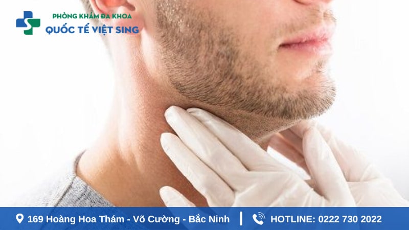 Đau rát cổ họng là dấu hiệu bệnh lậu ở miệng