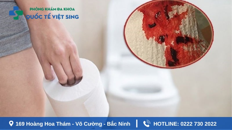 Đi ngoài ra máu là dấu hiệu của bệnh gì?