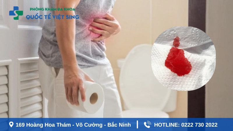 Giải đáp: Đi ngoài ra máu tươi cuối bãi là bệnh gì?