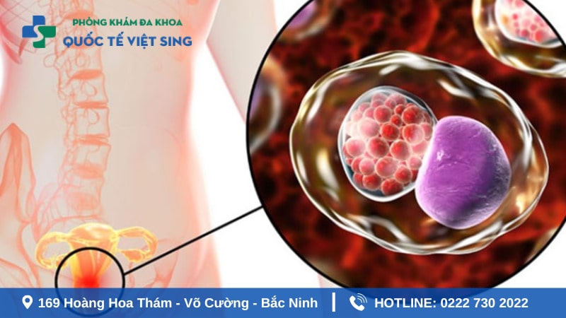 Đôi nét về bệnh lậu và triệu chứng ban đầu