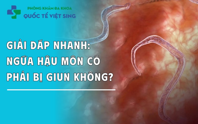 Giải đáp nhanh: Ngứa hậu môn có phải bị giun không?