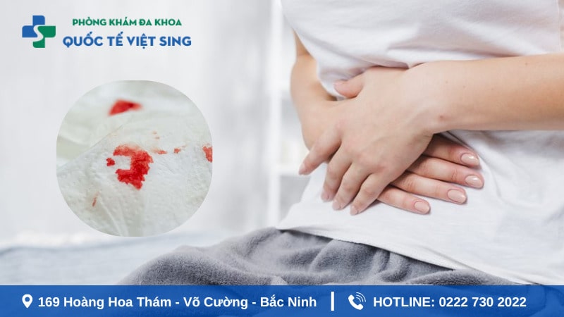 Hiện tượng đi ngoài ra máu tươi cuối bãi là gì?