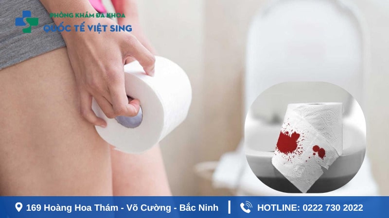 Khám đi ra ngoài ra máu là khám những gì? 