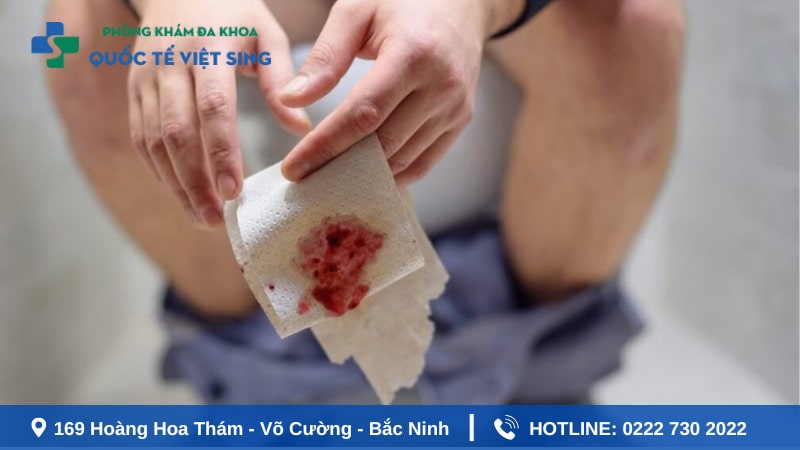 Khi nào cần đến gặp bác sĩ vì đi ngoài ra máu?