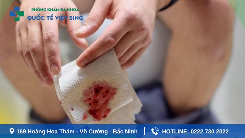 Nguyên nhân gây đi đại tiện ra máu cần chú ý