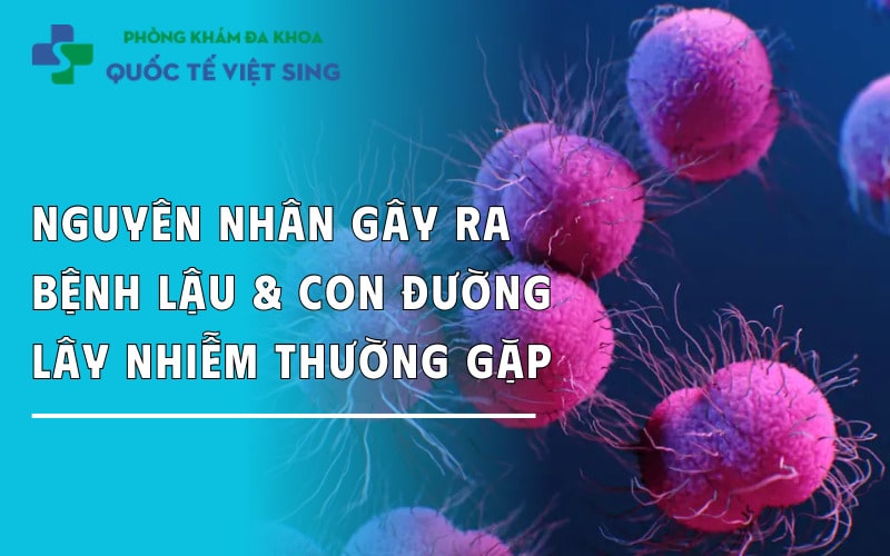 https://dakhoaquoctebacninh.com/wp-content/uploads/2025/06/nguyen-nhan-gay-benh-lau-va-con-duong-lay-benh-thuong-gap.jpg
