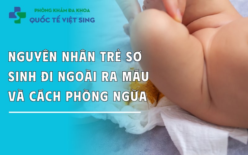 https://dakhoaquoctebacninh.com/wp-content/uploads/2025/06/nguyen-nhan-tre-so-sinh-di-ngoai-ra-mau.jpg