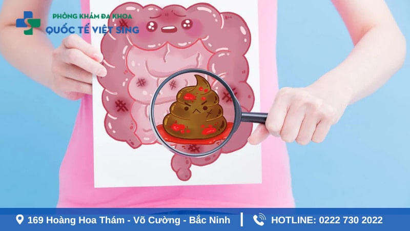Những đối tượng dễ bị táo bón ra máu