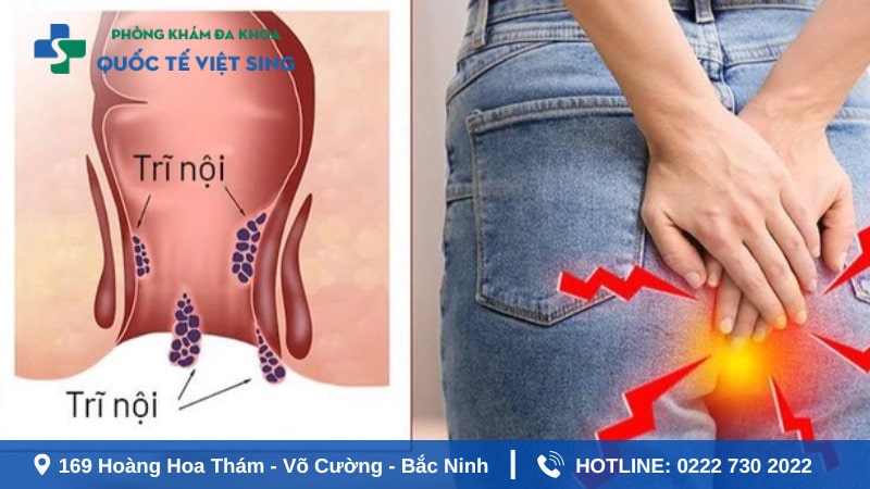 Nóng trong đi ngoài ra máu là dấu hiệu của bệnh gì?