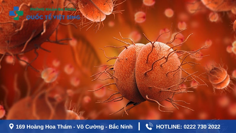 Phương pháp chẩn đoán bệnh lậu