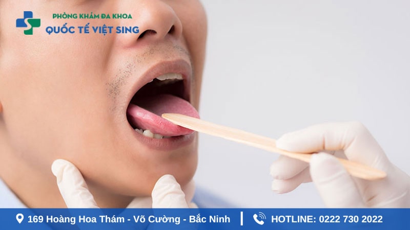 Phương pháp điều trị bệnh lậu ở miệng hiệu quả