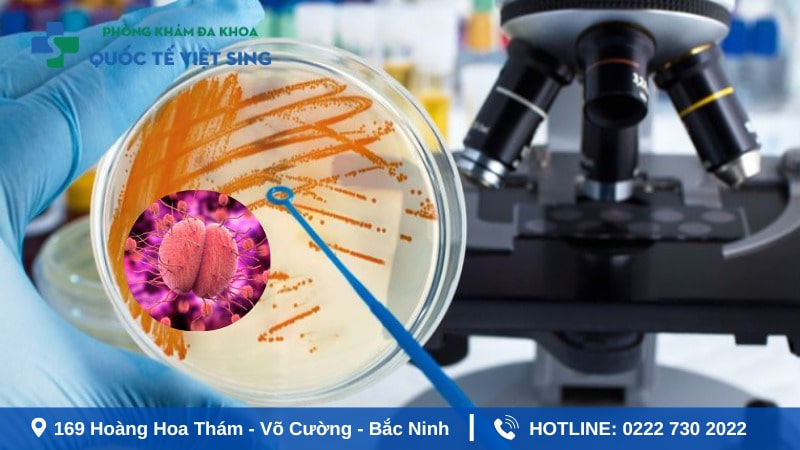 Phương pháp xét nghiệm bệnh lậu phổ biến hiện nay