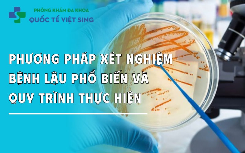 Phương pháp xét nghiệm bệnh lậu phổ biến và Quy trình thực hiện