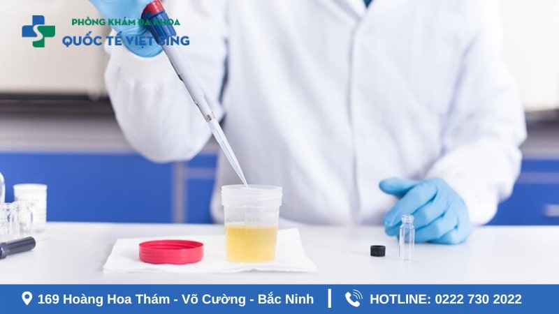 Quy trình thực hiện xét nghiệm bệnh lậu cụ thể