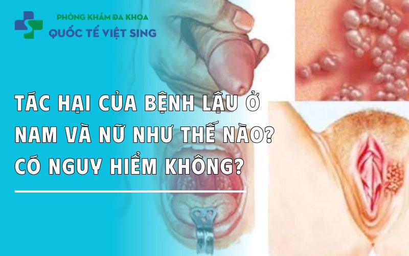 https://dakhoaquoctebacninh.com/wp-content/uploads/2025/06/tac-hai-cua-benh-lau-doi-voi-nam-va-nu-gioi-nhu-the-nao.jpg