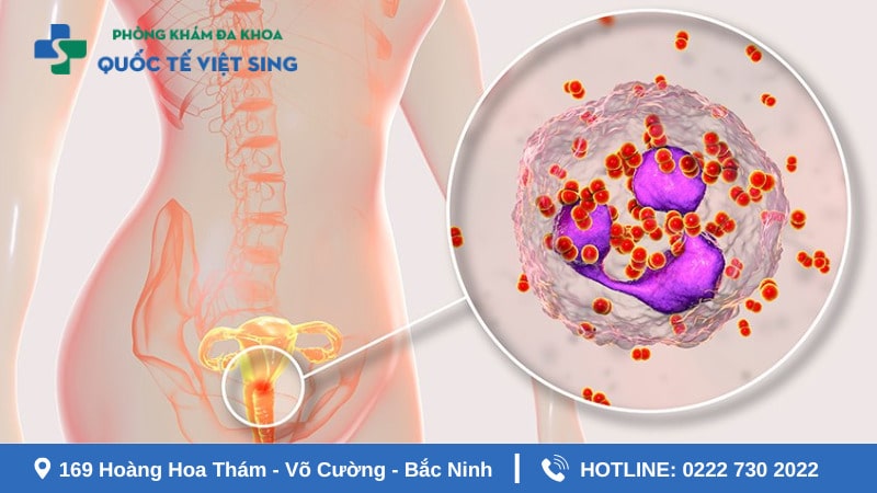 Tác hại của bệnh lậu đối với nữ giới