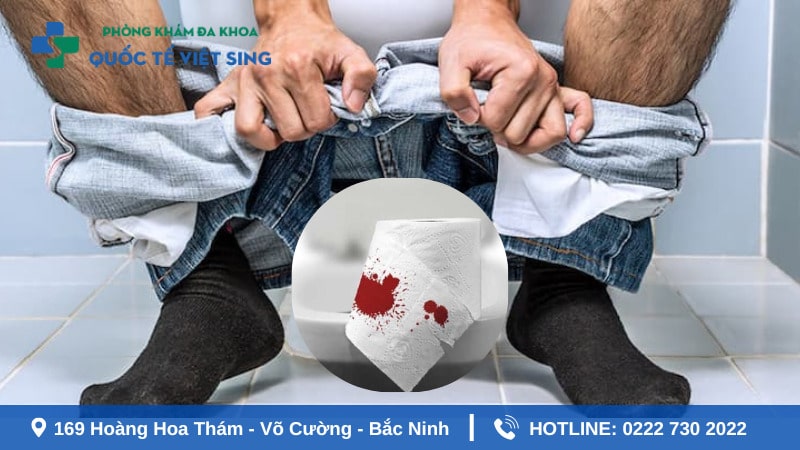 Bị táo bón đi ngoài ra máu có nguy hiểm không?