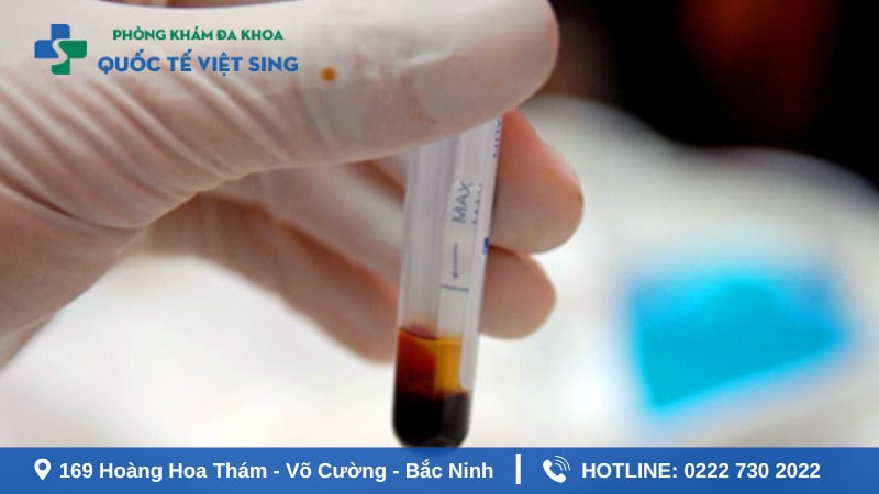 Thời điểm cần thực hiện xét nghiệm máu chẩn đoán bệnh lậu