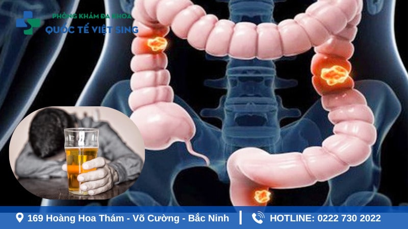 Tổn thương do viêm loét đại trực tràng