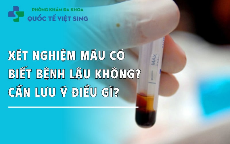 Xét nghiệm máu có biết bệnh lậu không? Cần lưu ý điều gì?