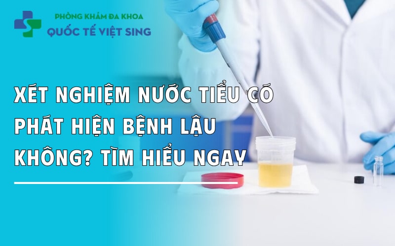 Xét nghiệm nước tiểu có phát hiện bệnh lậu không? Tìm hiểu ngay