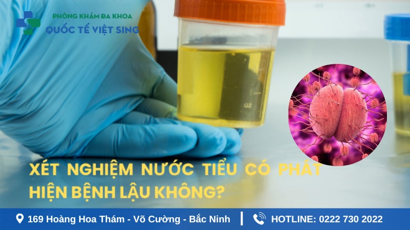 Xét nghiệm nước tiểu có phát hiện bệnh lậu không?