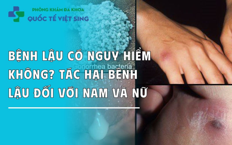 Bệnh lậu có nguy hiểm không? Tác hại bệnh lậu đối với nam và nữ