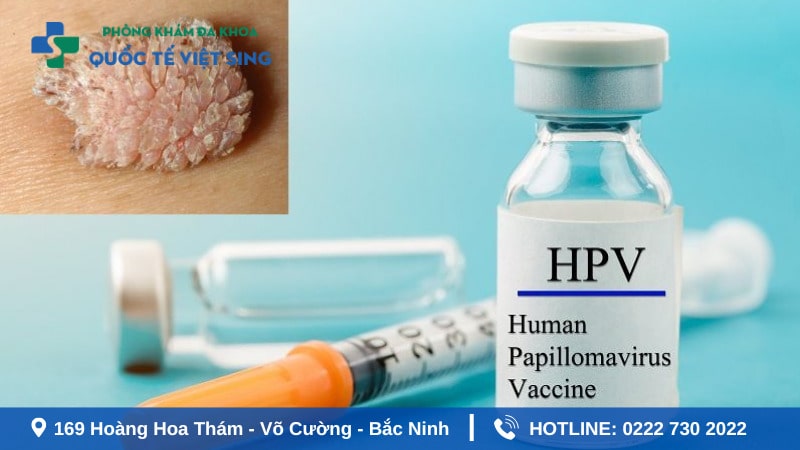 Biện pháp phòng ngừa bệnh sùi mào gà hiệu quả