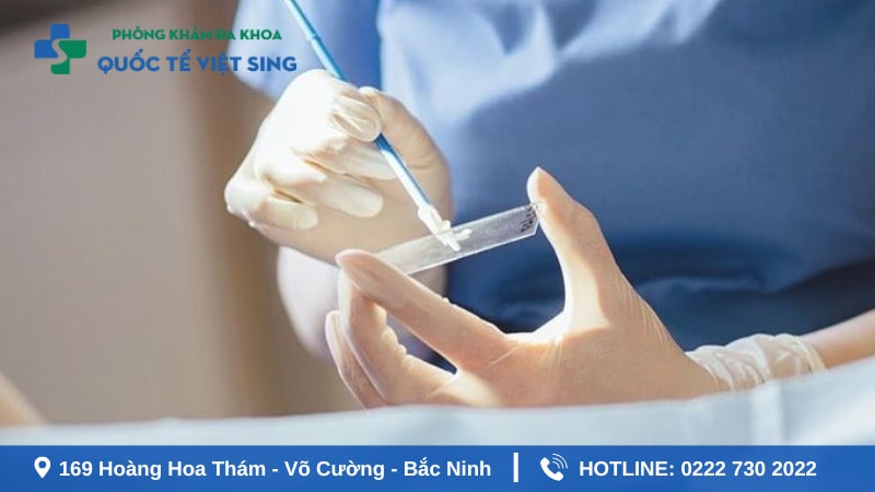 Chẩn đoán và điều trị bệnh sùi mào gà hiệu quả