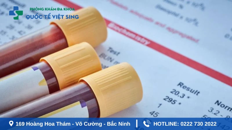 Chi phí chữa bệnh lậu phụ thuộc vào loại xét nghiệm