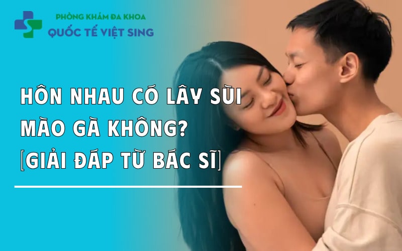 Hôn nhau có lây sùi mào gà không? [Giải đáp từ bác sĩ]