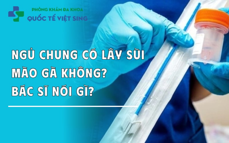 Ngủ chung có lây sùi mào gà không? – Bác sĩ nói gì?