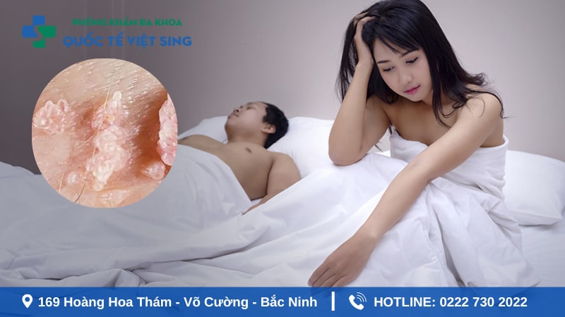Ngủ chung có lây sùi mào gà không? Giải đáp từ bác sĩ